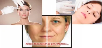 Botoks Nedir Estetik Açıdan Faydaları?